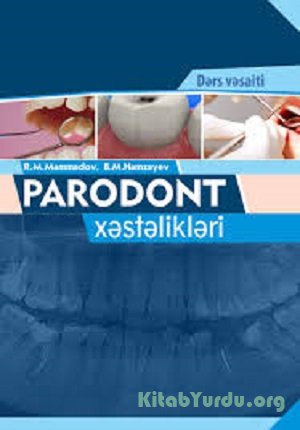 Parodont xəstəlikləri